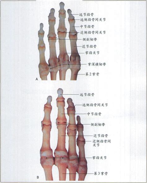 指根|手掌中指根部关节疼痛